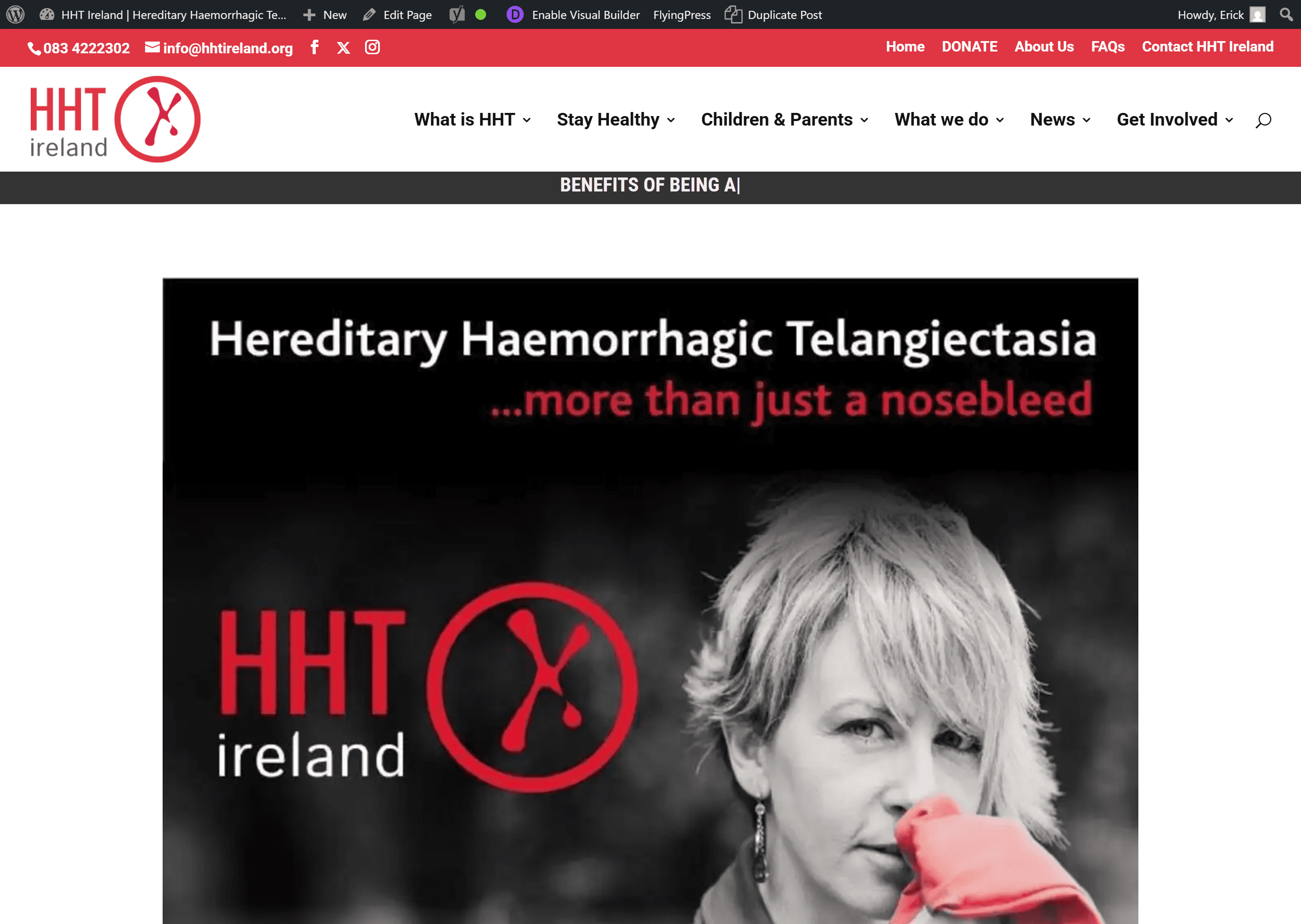 HHT Ireland (Volunteer Web Content Editor)